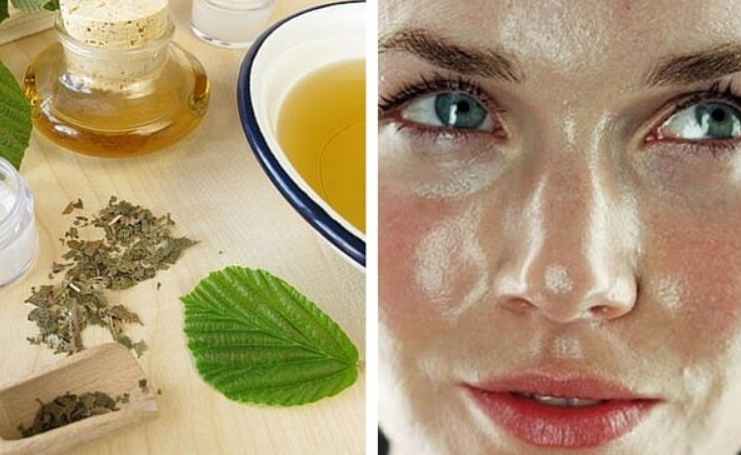 remedios naturales para el cutis graso